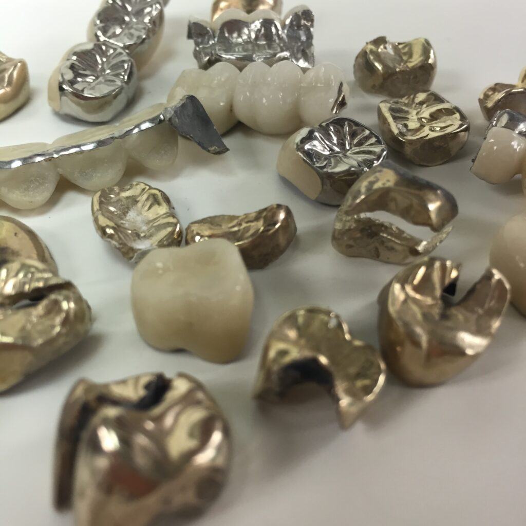 Dental scrap is very valuable. Assume all dental gold and scrap has value when selling it to a precious metals refinery.