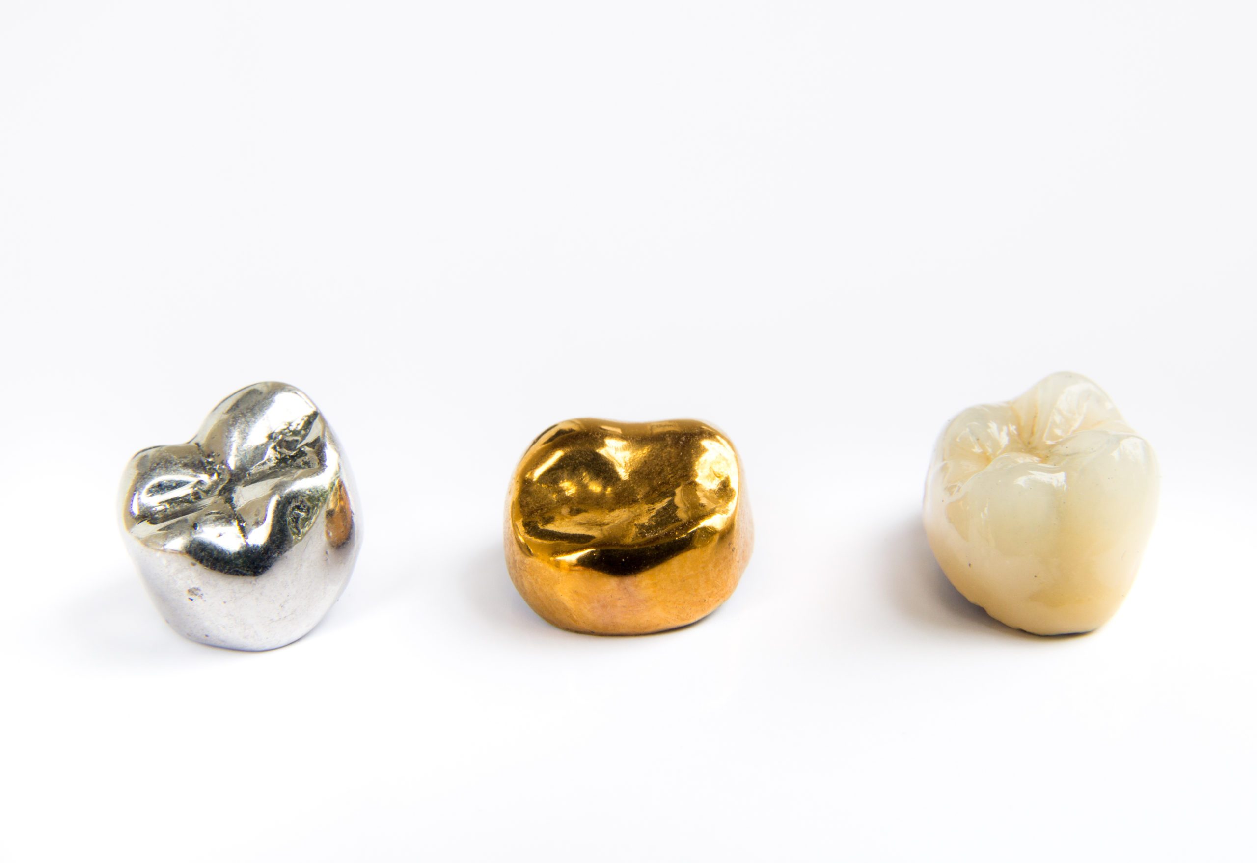 Dental gold is valuable, and the process of selling dental gold is much easier than you may think.