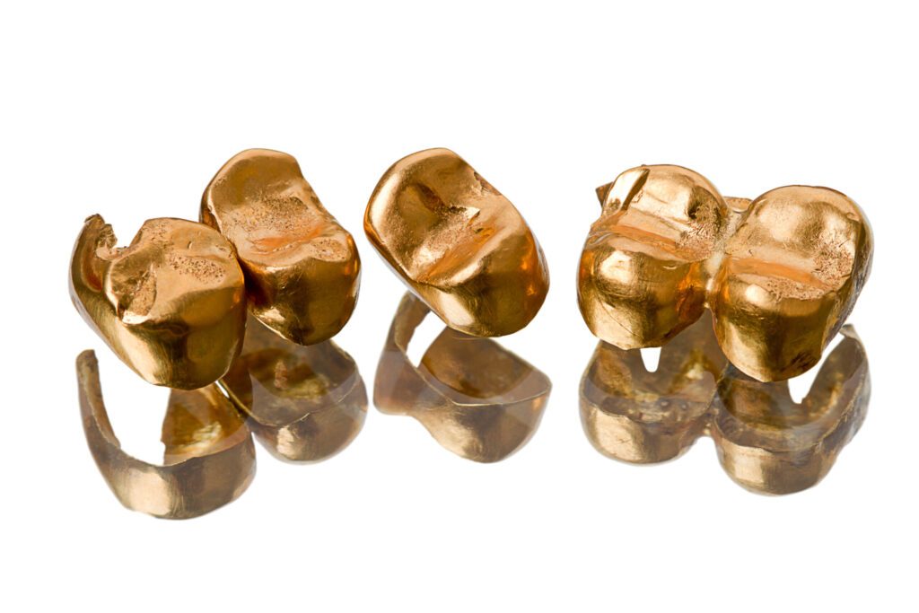 Make Money by Recycling Gold Buttons, Buckles and Cufflinks – America's  Best Gold Refiners