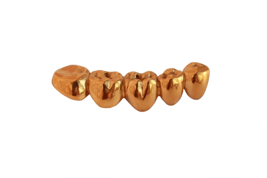 mandibular gold teeth