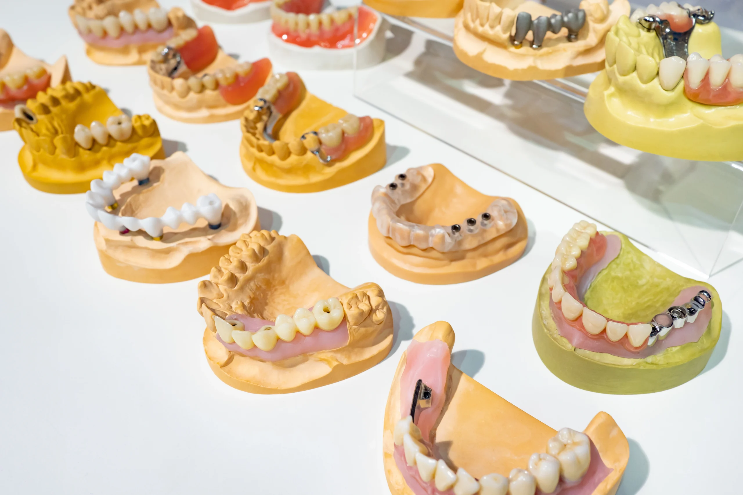 Precious metal dental crowns in production
