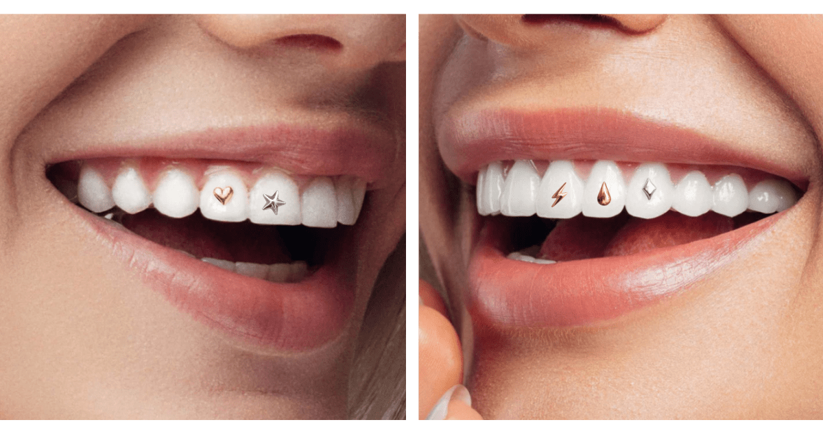 Two images of close -up smiling people featuring silver and gold tooth gems.