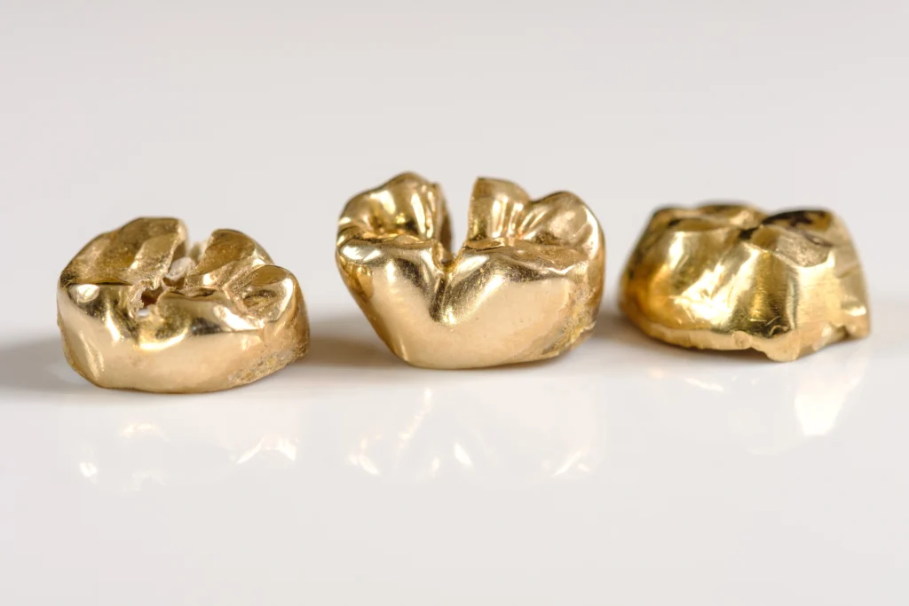 3 gold dental crown display on a white backdrop