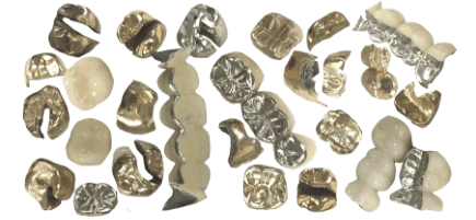 A collection of gold crowns and bridges ready to be refined